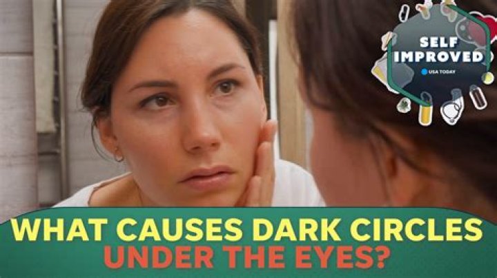 Kim Kardashian: Dark Circles Under Her Eyes — How To Cover Them Up